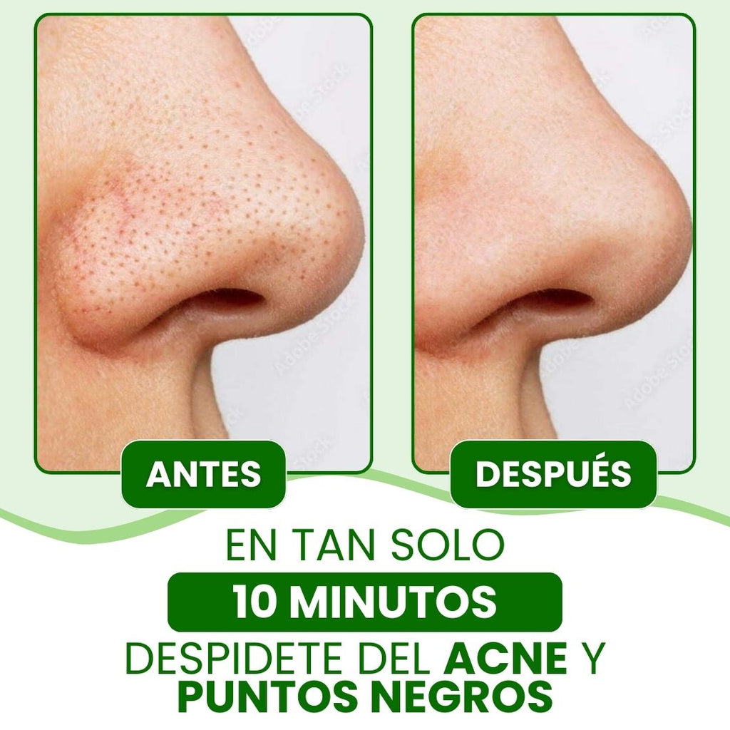 Lanbena®: Mascarilla Coreana Avanzada para puntos negros